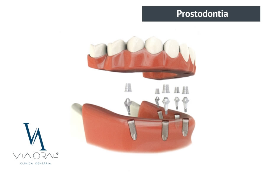 Prostodontia